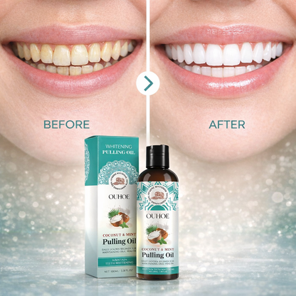 Coconut Oil Mouthwash – Fresh Breath & Natural Teeth Whitening